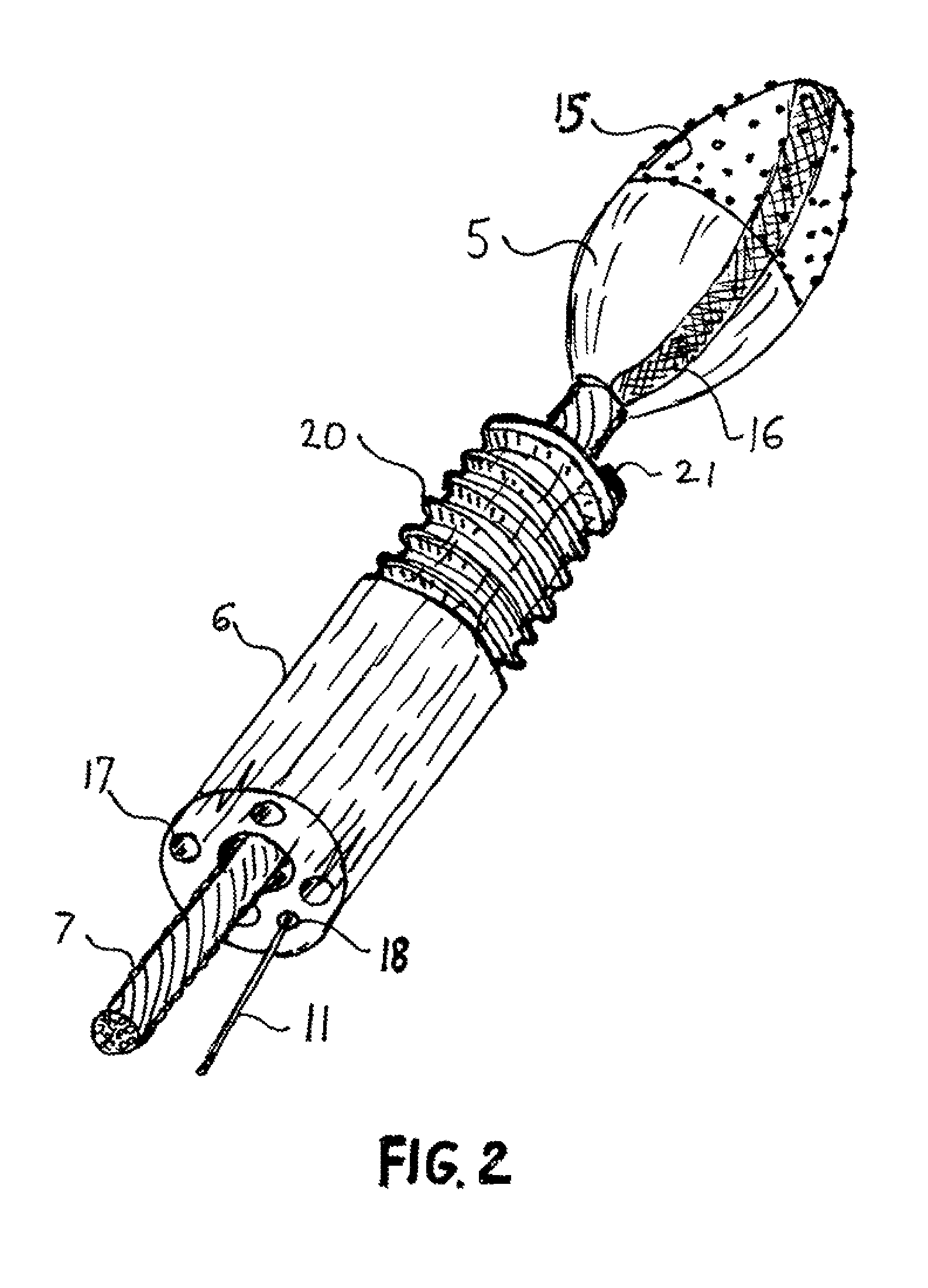 Automatic atherectomy system