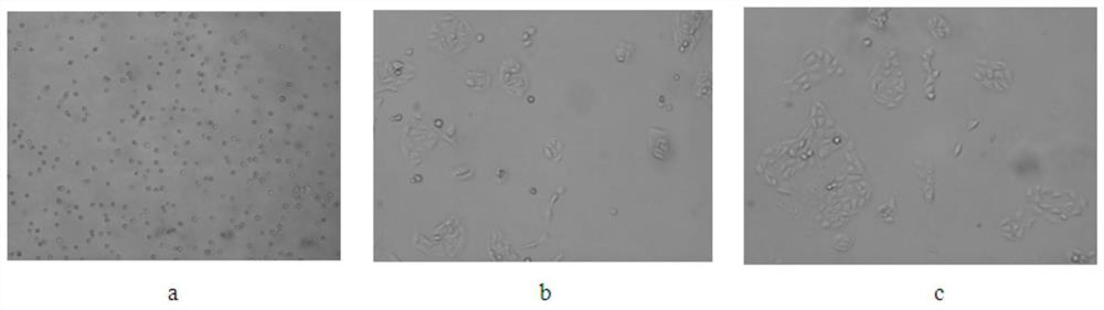 A traditional Chinese medicine composition capable of inhibiting the proliferation of lung cancer cells and its application