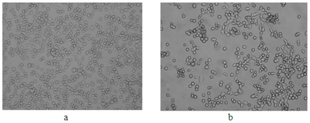 A traditional Chinese medicine composition capable of inhibiting the proliferation of lung cancer cells and its application