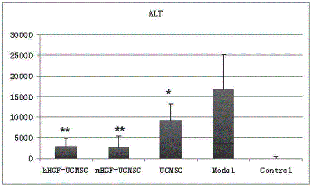 Preparation method of UCMSC (umbilical cord mesenchymal stem cell) modified with HGF (hepatocyte growth factor) gene and used for treating liver failure