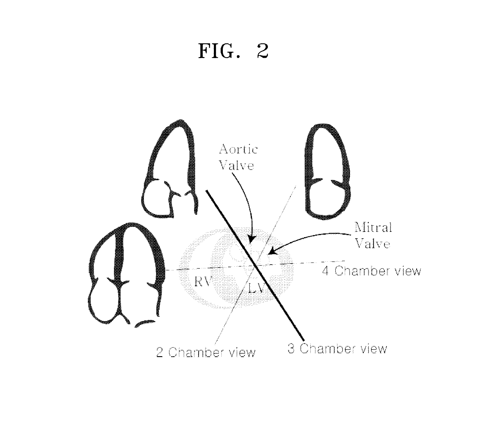 Ultrasonic diagnostic apparatus and method thereof