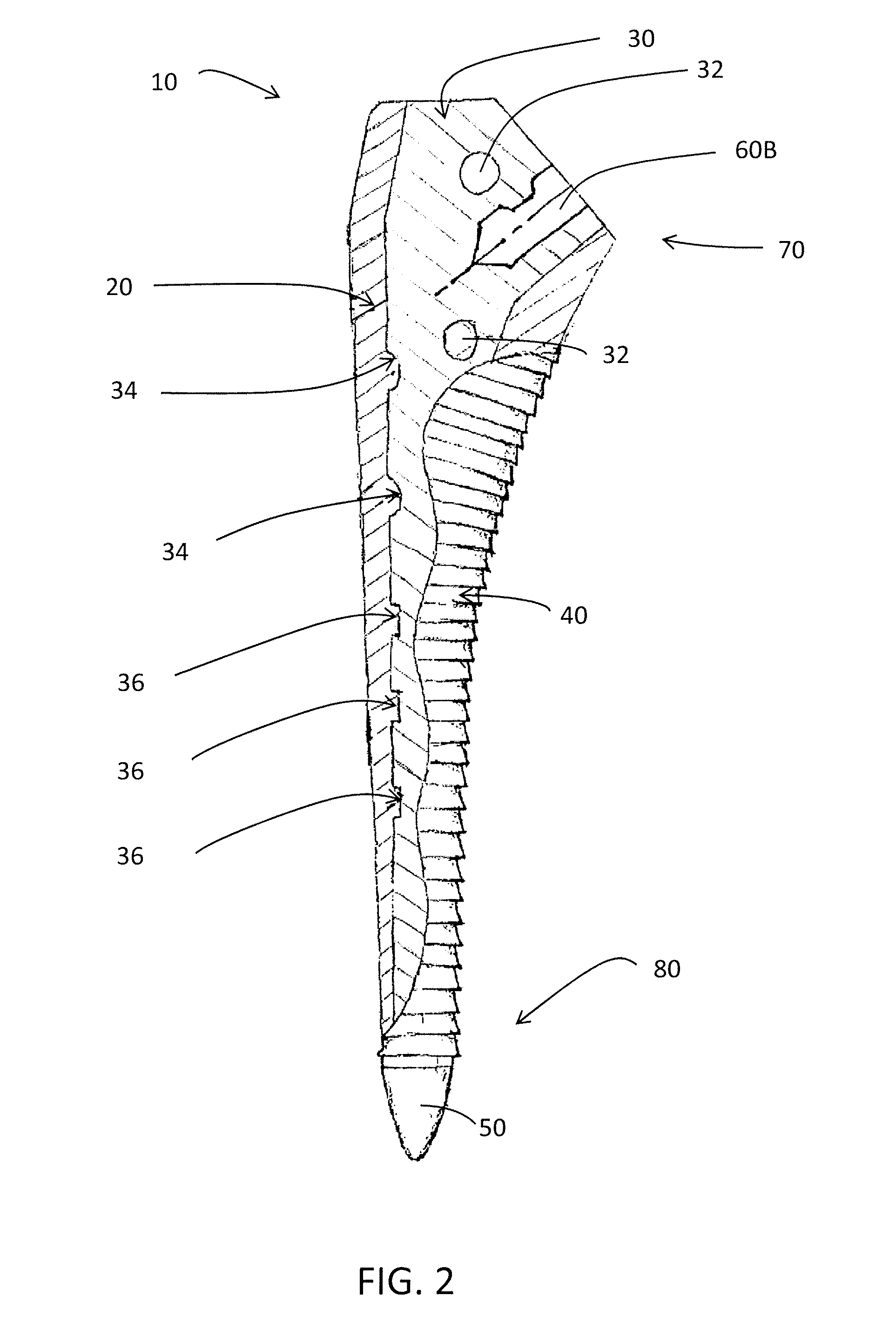 Device for use in orthopaedic surgery