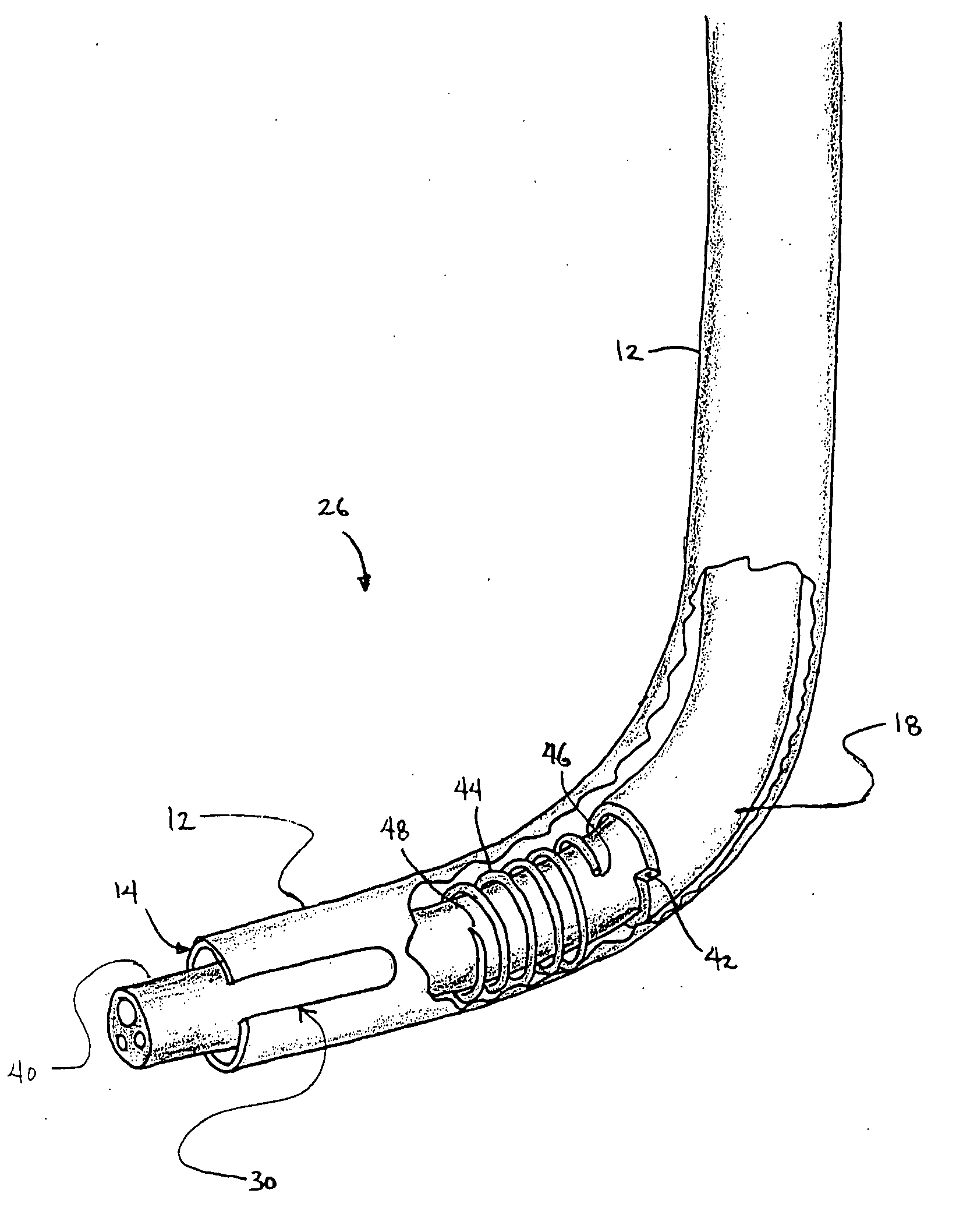 Overtube apparatus for insertion into a body