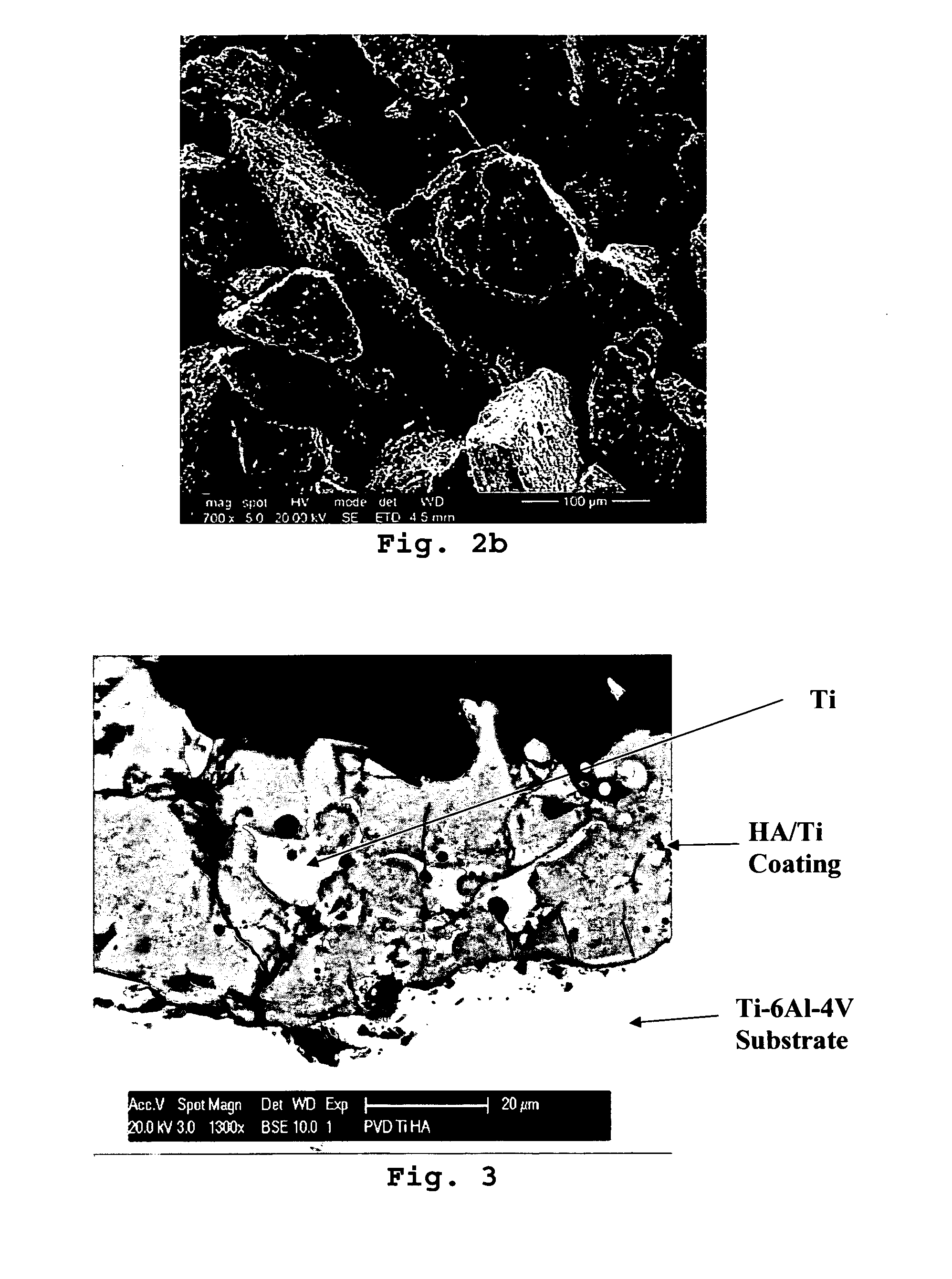 Coating method