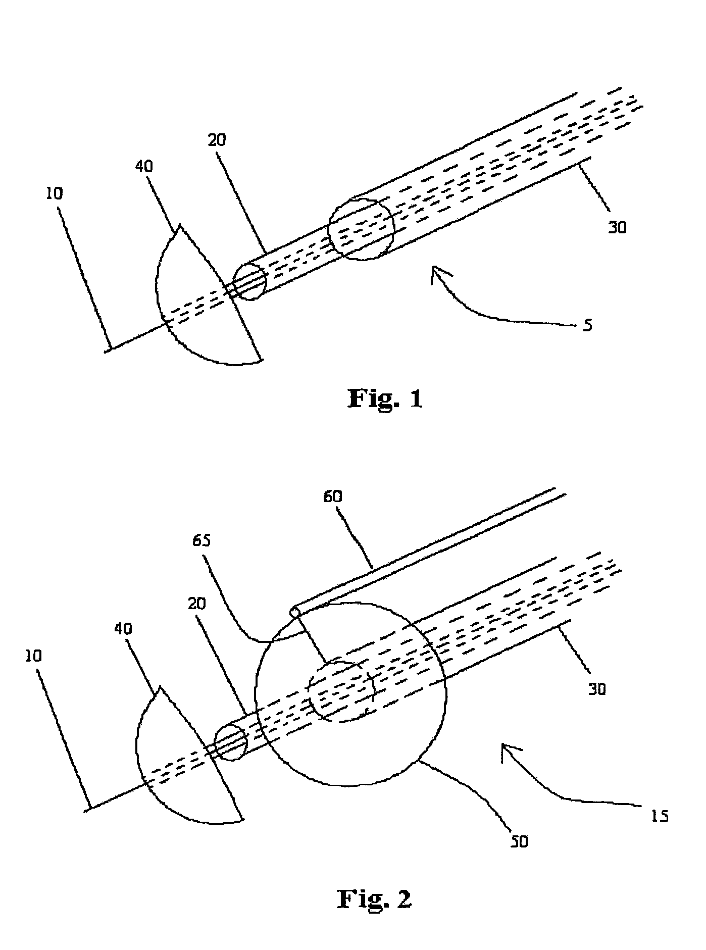 Apparatus and method for cutting a heart valve