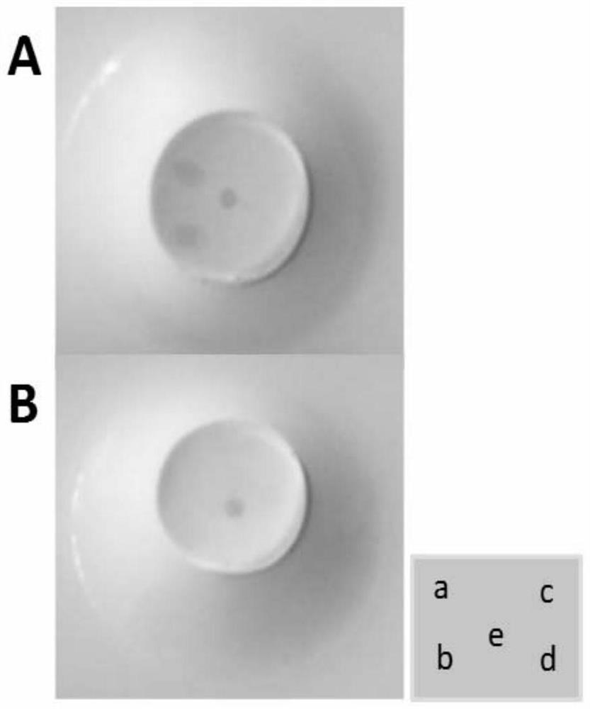 Application of lipopolysaccharide extracted from Brucella melis vaccine strain m5 in the preparation of products for diagnosing human brucellosis