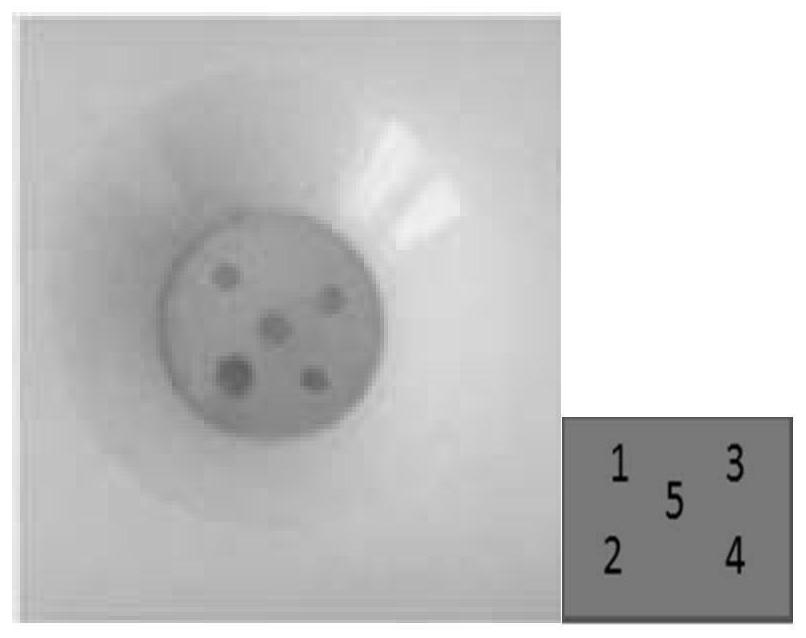 Application of lipopolysaccharide extracted from Brucella melis vaccine strain m5 in the preparation of products for diagnosing human brucellosis