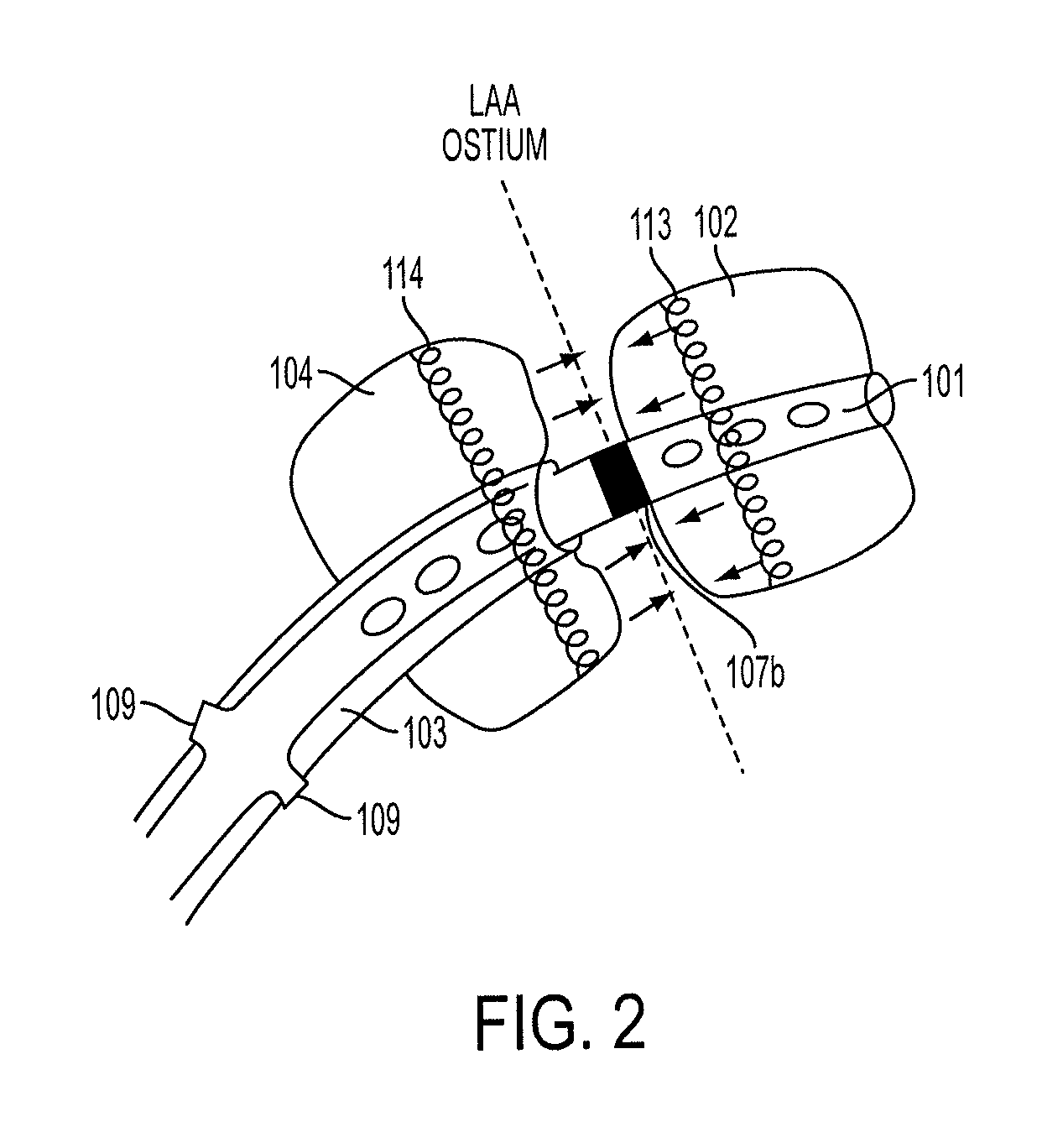 Methods and systems for accessing a pericardial space and preventing strokes arising from the left atrial appendage