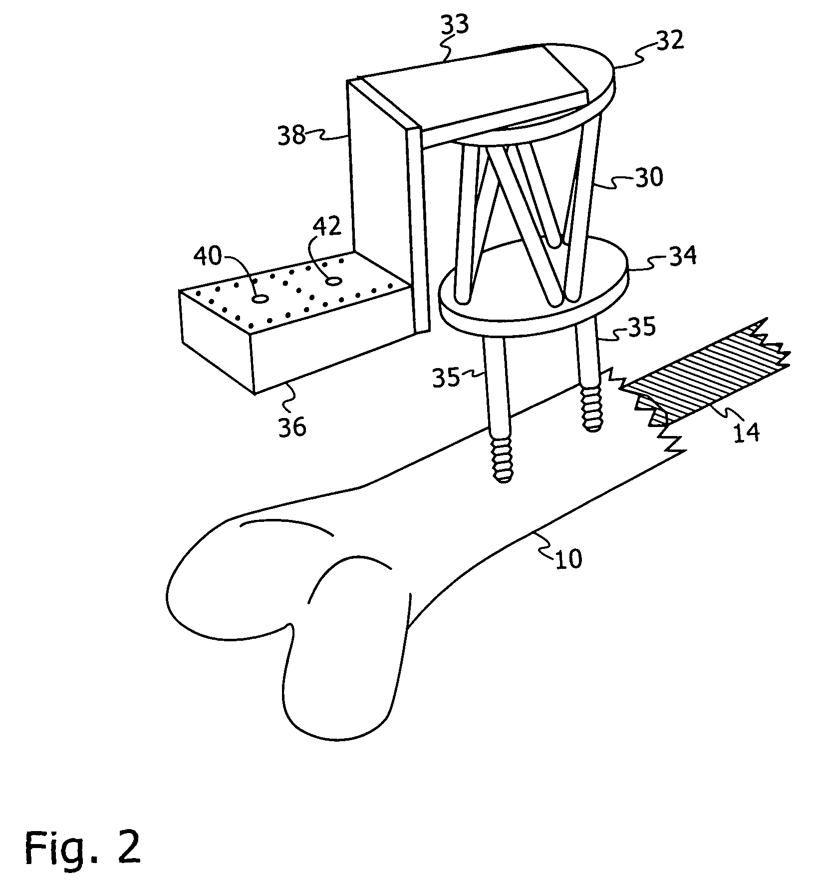 Robotic method for use with orthopedic inserts