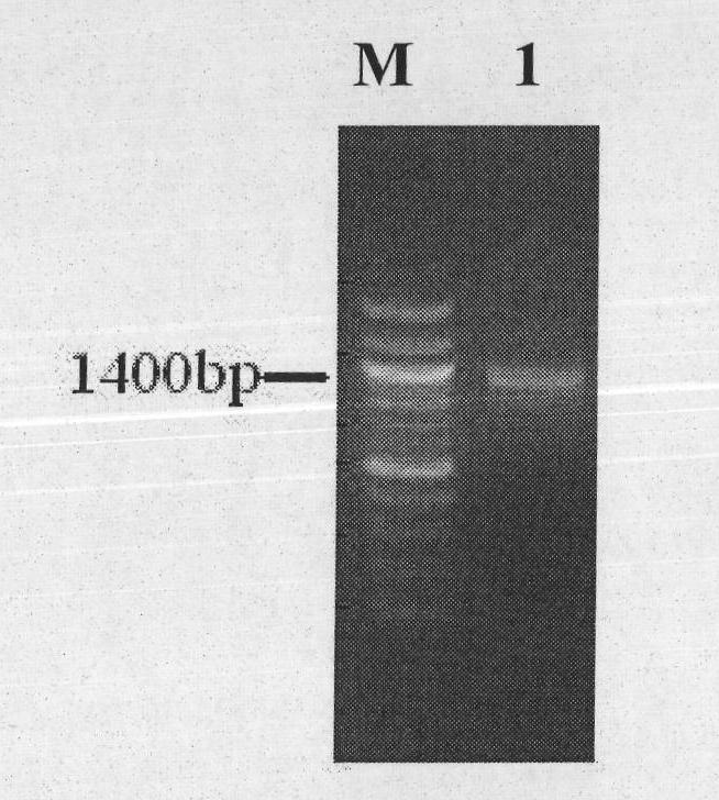 Immune liposome based on Isthmin gene as well as preparation method and application thereof