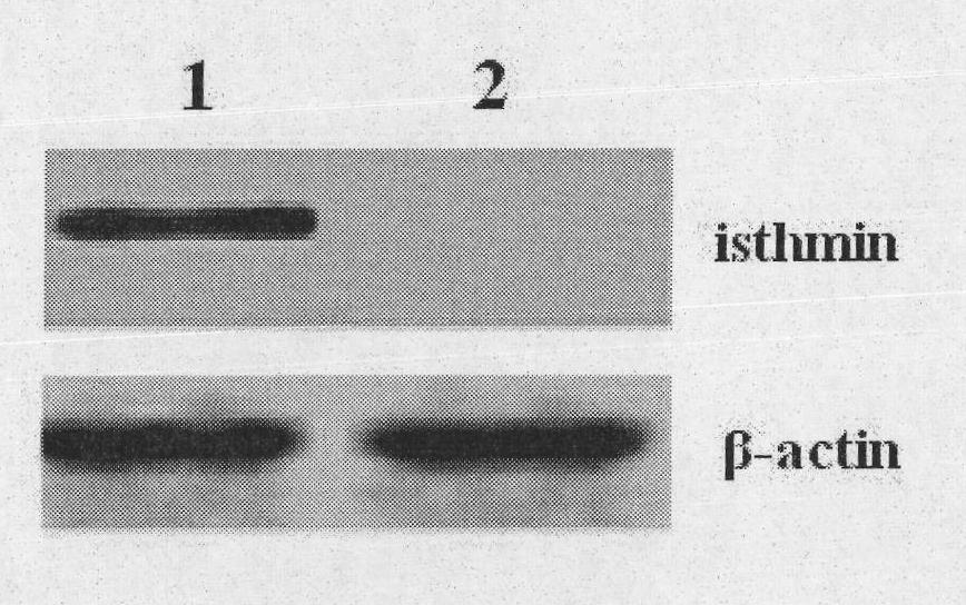 Immune liposome based on Isthmin gene as well as preparation method and application thereof