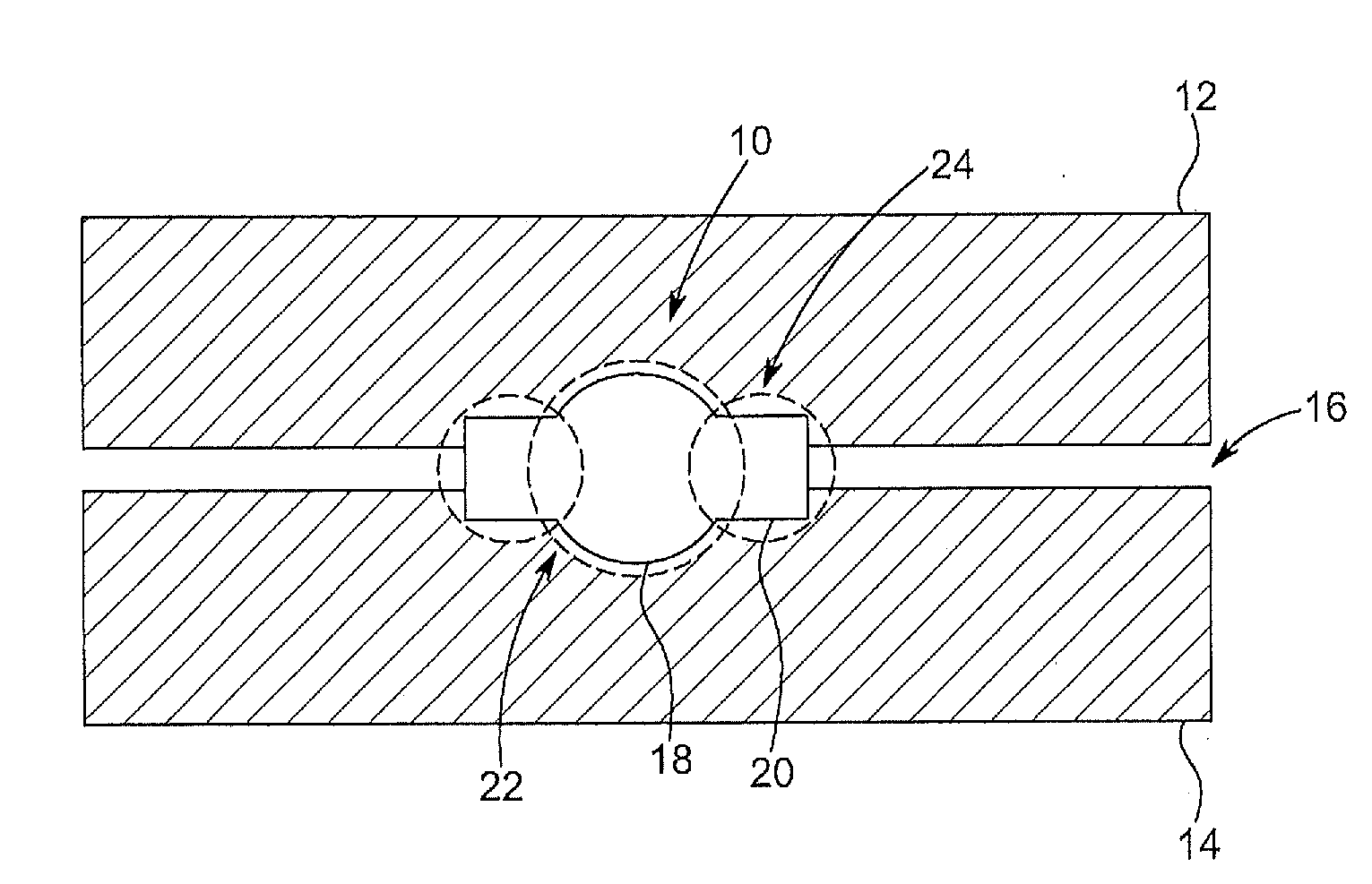 Surgical implant device and surgical implant insertion assembly for the translation and fusion of a facet joint of the spine