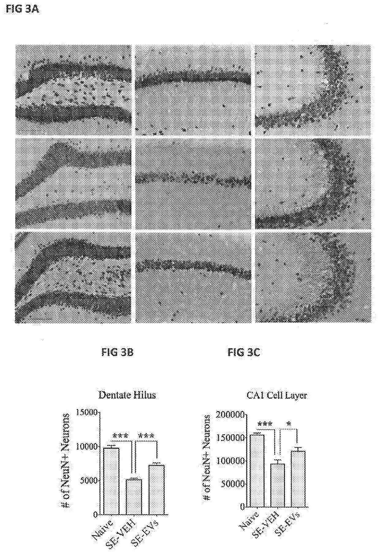 Exosomes and uses thereof in diseases of the brain