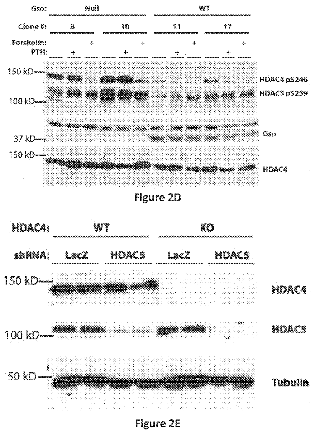 Uses of salt-inducible kinase (SIK) inhibitors for treating osteoporosis