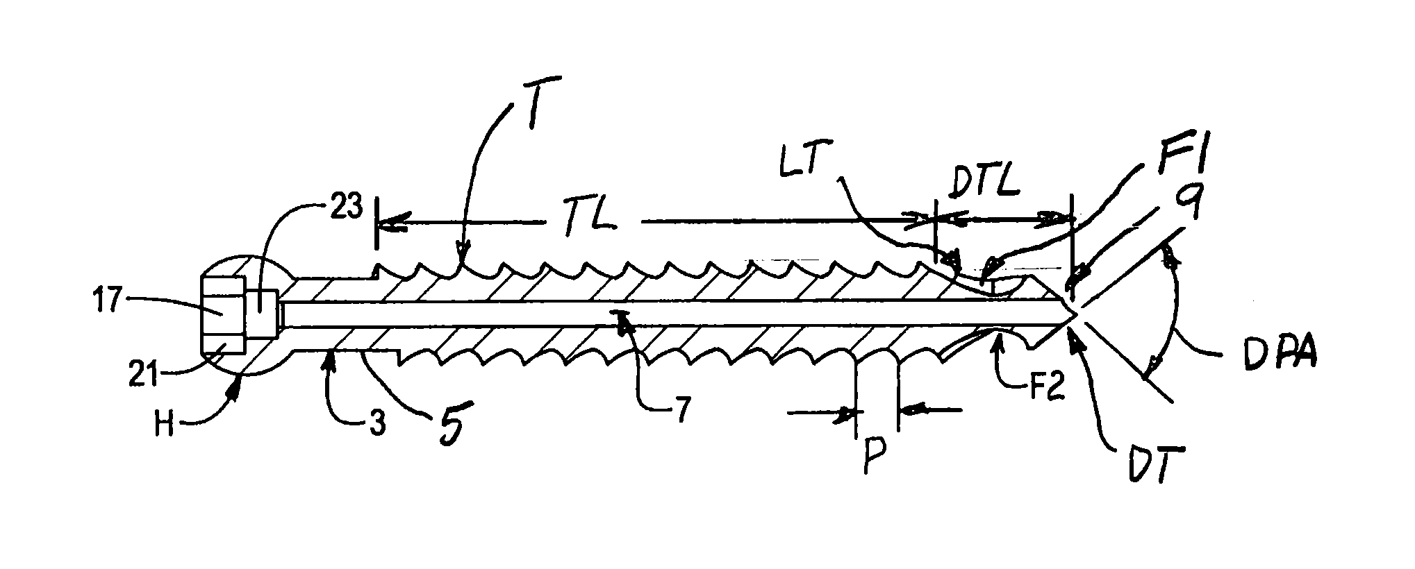 Self drilling, self-tapping bone screw and method of installing for bicortical purchase