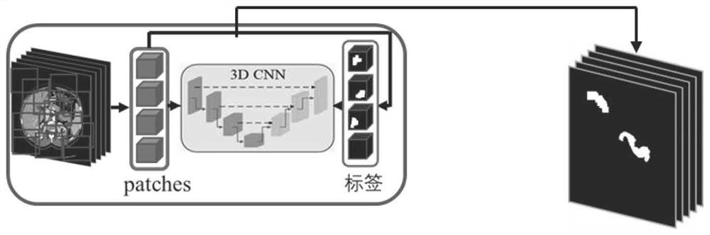 Medical image segmentation task lightweight system construction method