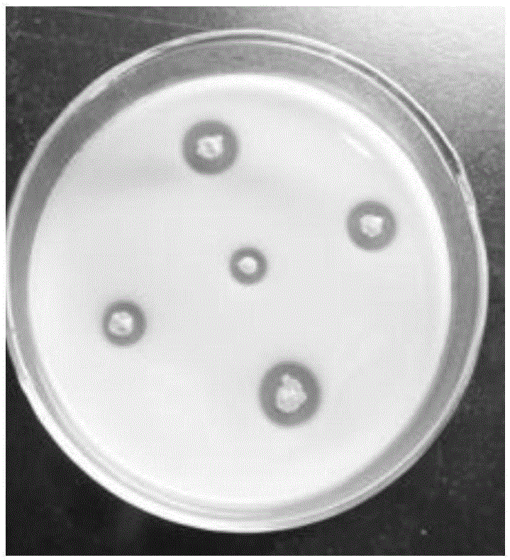 Acid-resistant, ethanol-resistant and acetic acid-resistant Acetobacer pasteurianus