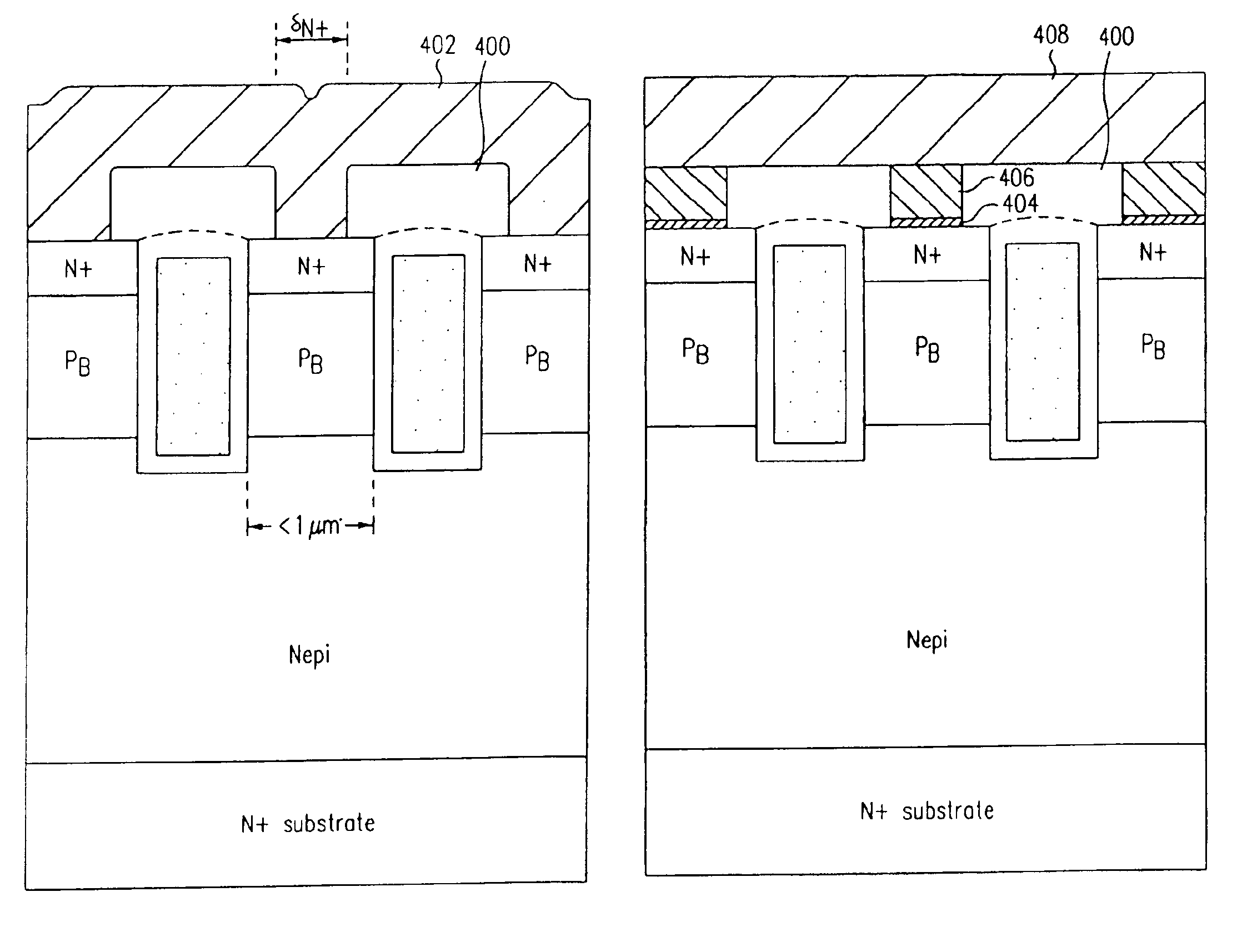Self-aligned trench transistor using etched contact