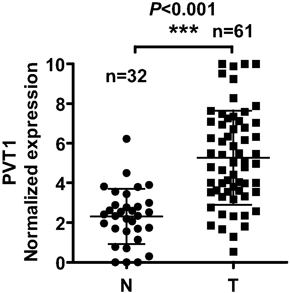 Application of interfering long-chain non-coding RNA PVT1 expression agent in the preparation of nasopharyngeal carcinoma radiotherapy sensitizer