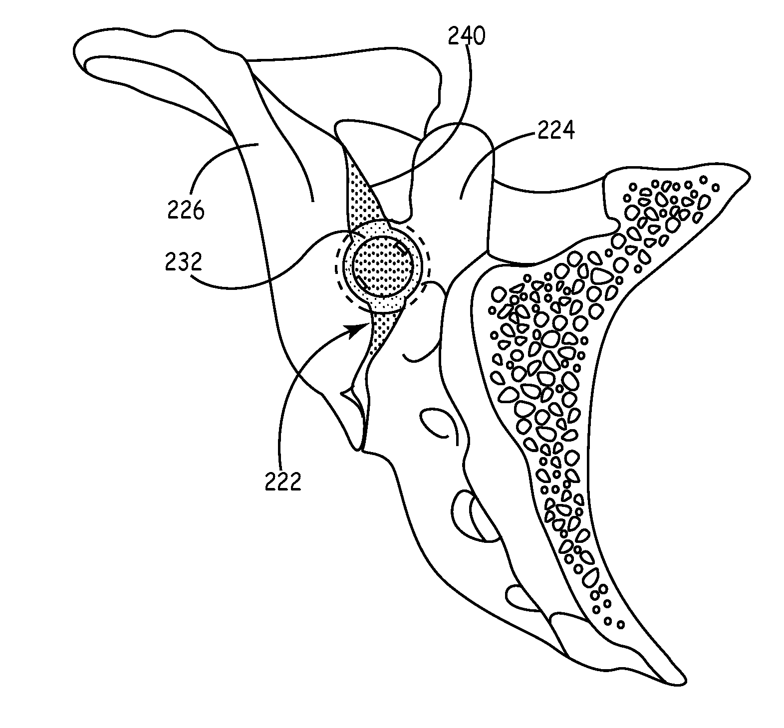 Methods for delivery of screws for joint fusion