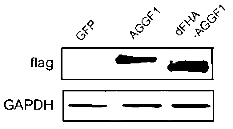 Protein AGGF1 and application of FHA polypeptide of protein AGGF1 in preparation of anti-inflammatory drug