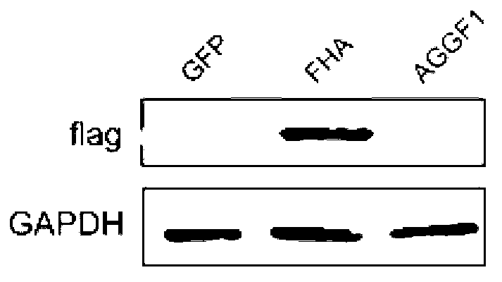 Protein AGGF1 and application of FHA polypeptide of protein AGGF1 in preparation of anti-inflammatory drug