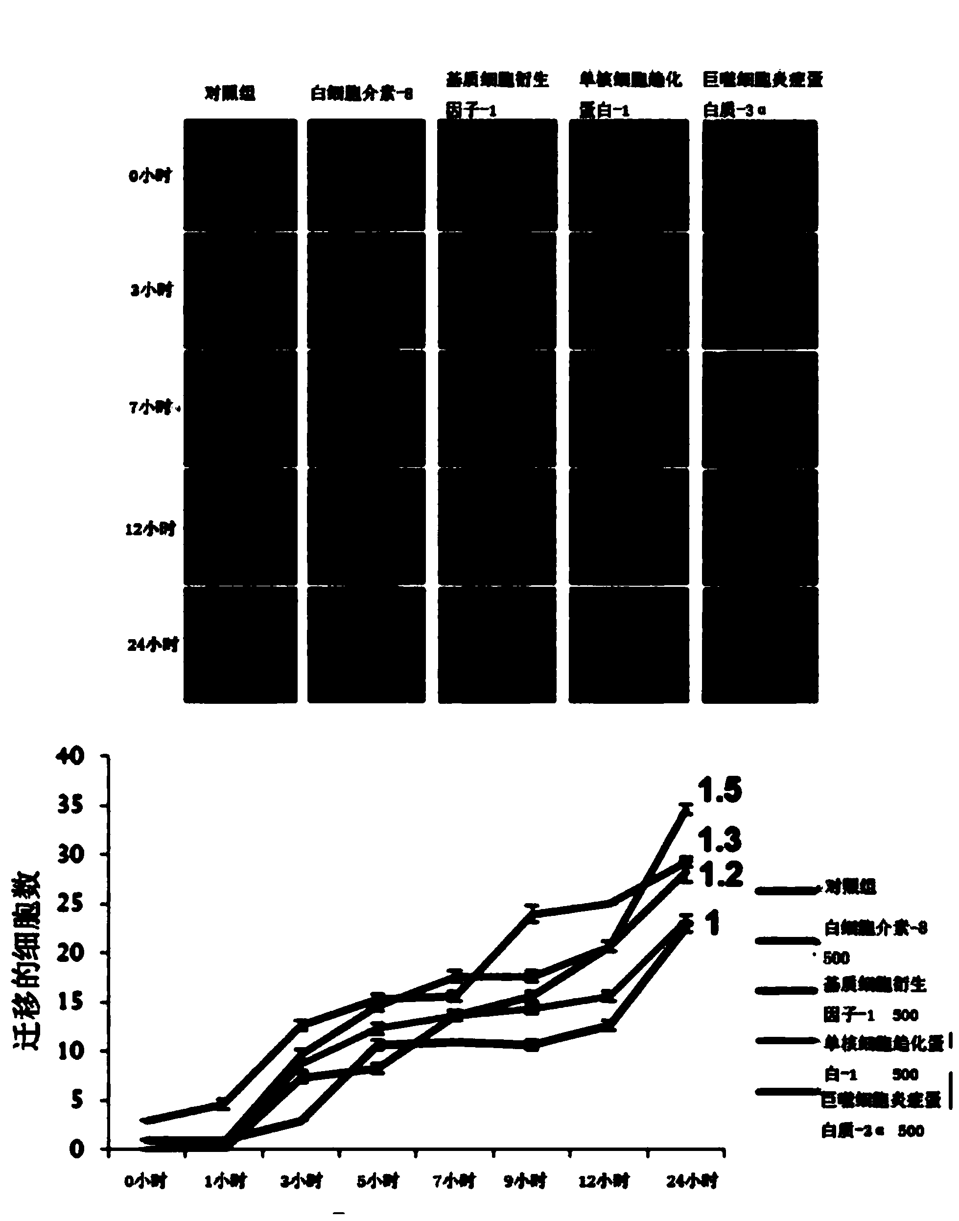 Method for inducing in vivo migration of stem cell