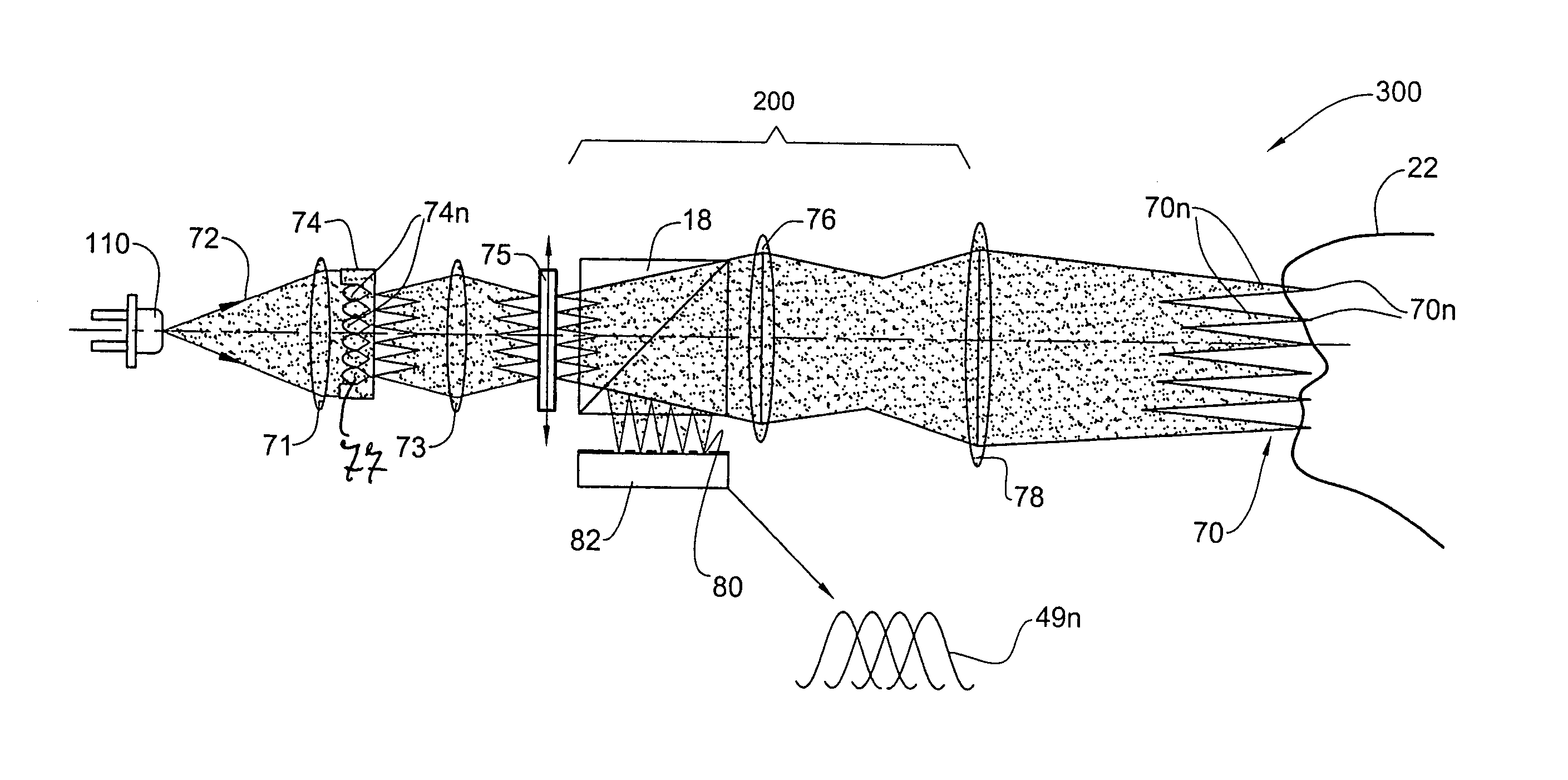 Apparatus and method for providing high intensity non-coherent light and for speckle reduction