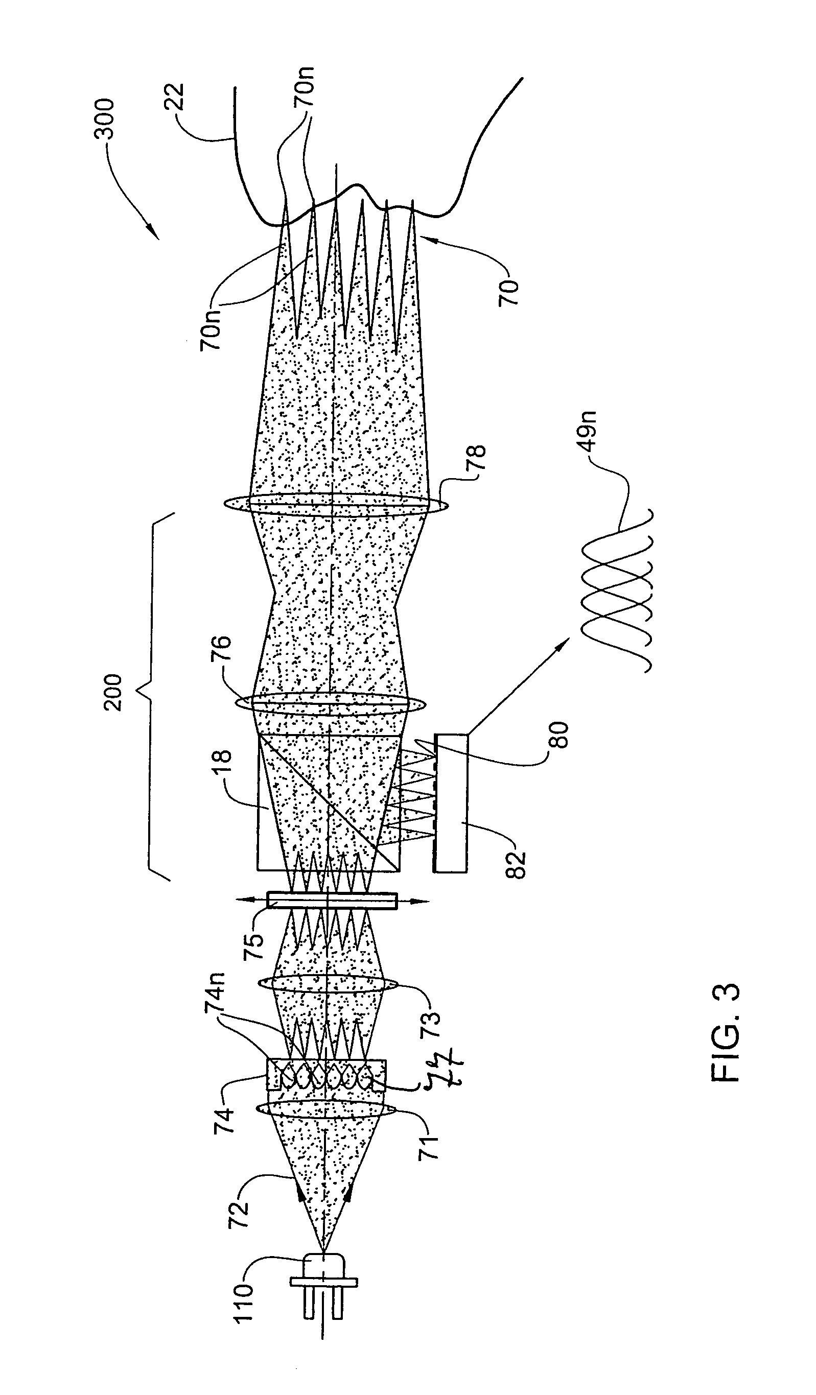 Apparatus and method for providing high intensity non-coherent light and for speckle reduction