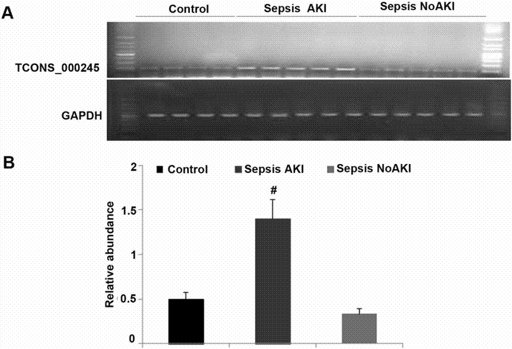 Molecular marker and kit for early diagnosis and prediction of septicopyemia complicated by acute kidney injury and application thereof