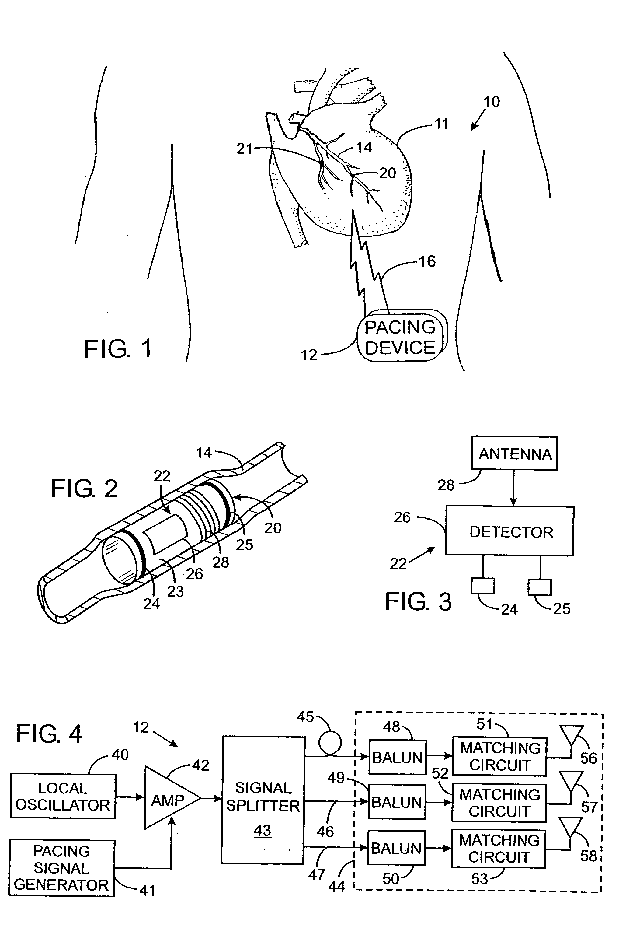 Omnidirectional antenna for wireless communication with implanted medical devices