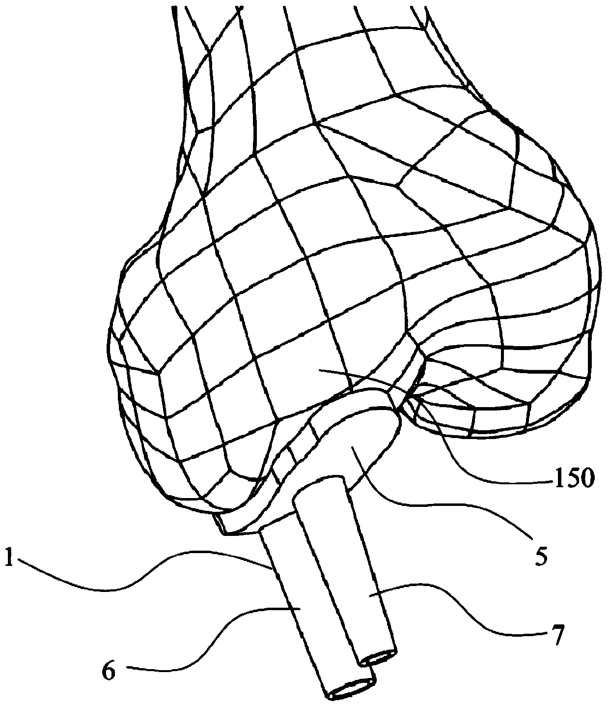Unicondylar osteotomy guide plate and positioning method thereof