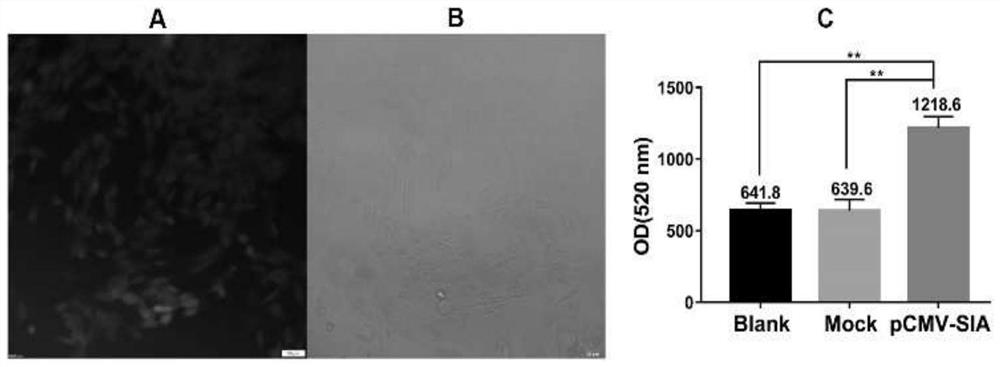 Recombinant expression vector for specifically and highly expressing SIA in muscle-derived cells and application of recombinant expression vector