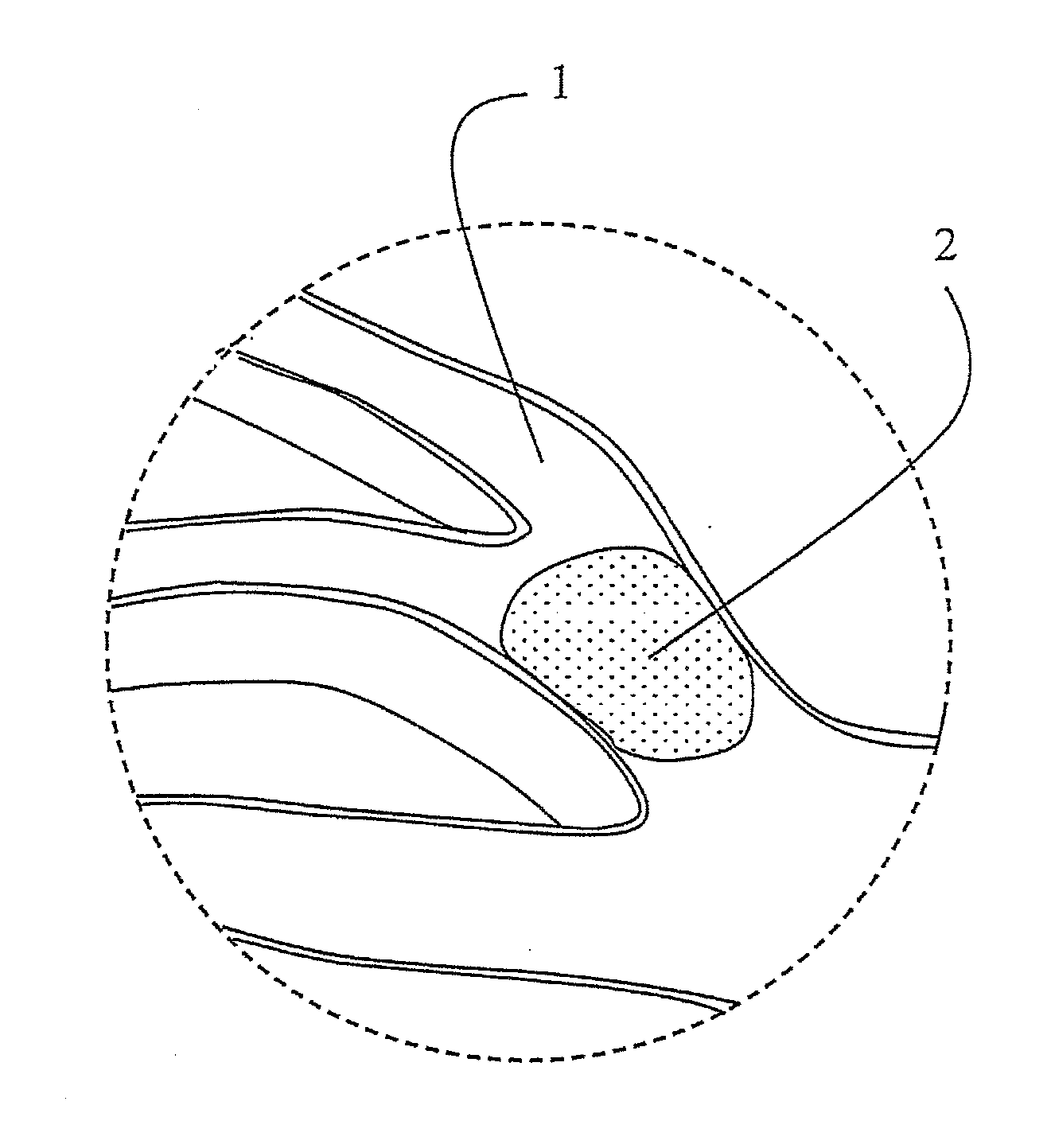 Clot retrieval devices