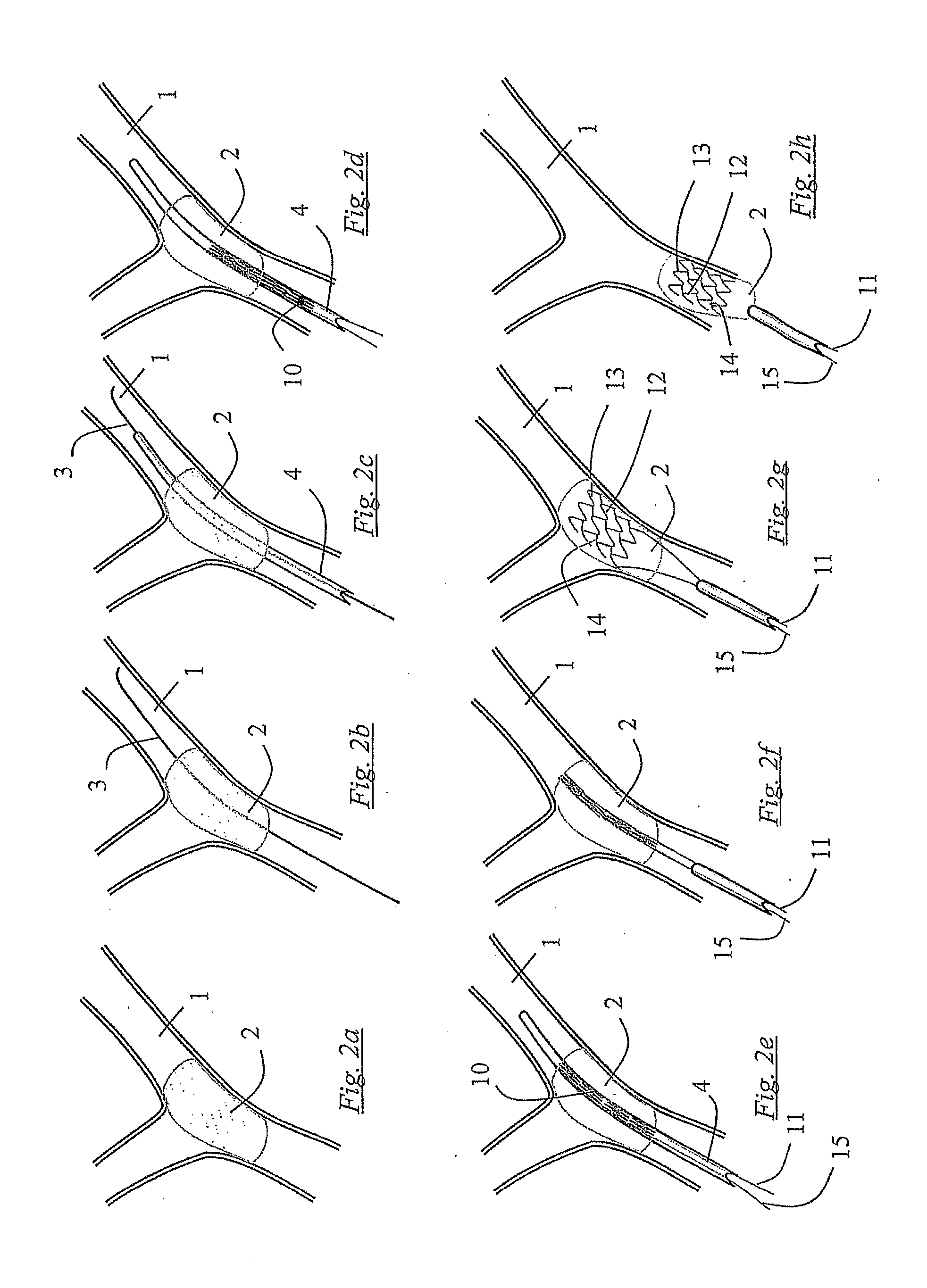 Clot retrieval devices