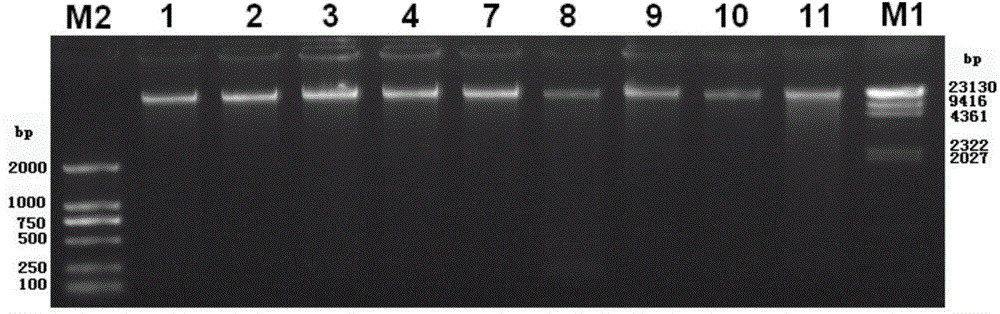Sputum collection method for detecting 16SrRNA gene sequence of respiratory tract bacteria