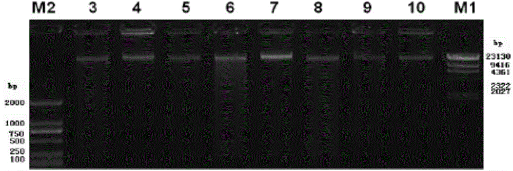 Sputum collection method for detecting 16SrRNA gene sequence of respiratory tract bacteria