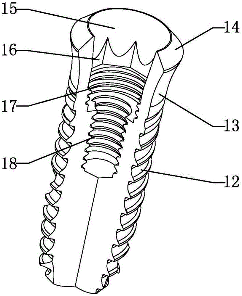 Easy-to-remove implant set and its screw-out tool