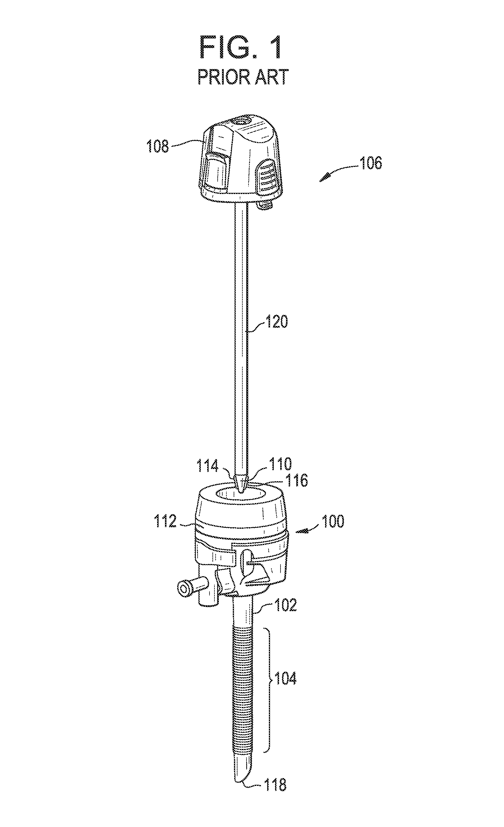 Device for anchoring a trocar