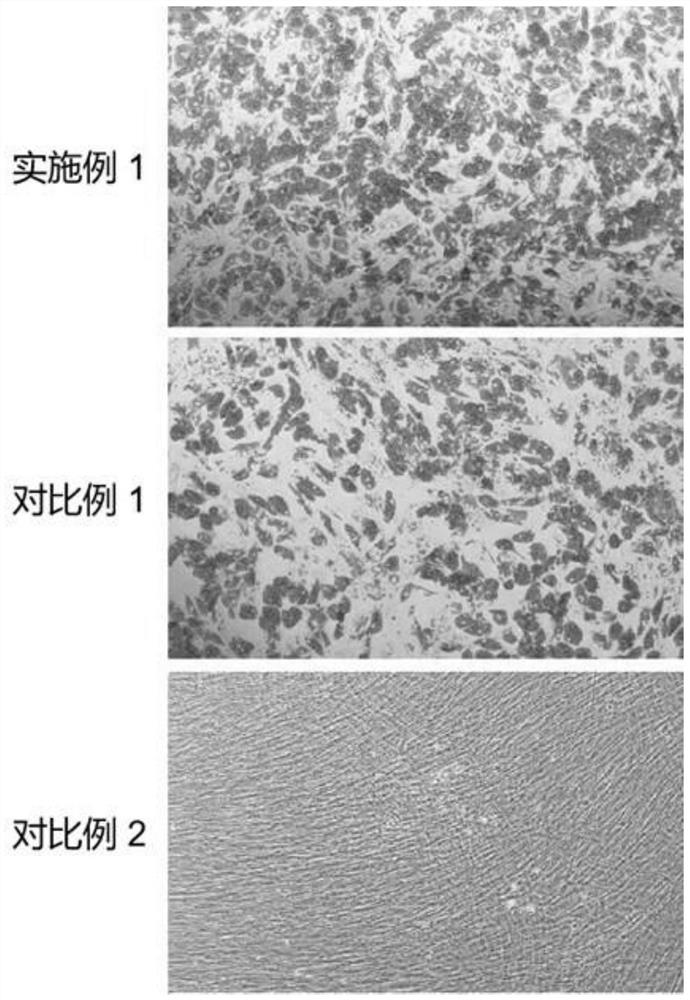 A kind of mesenchymal stem cell adipogenic differentiation medium and its application