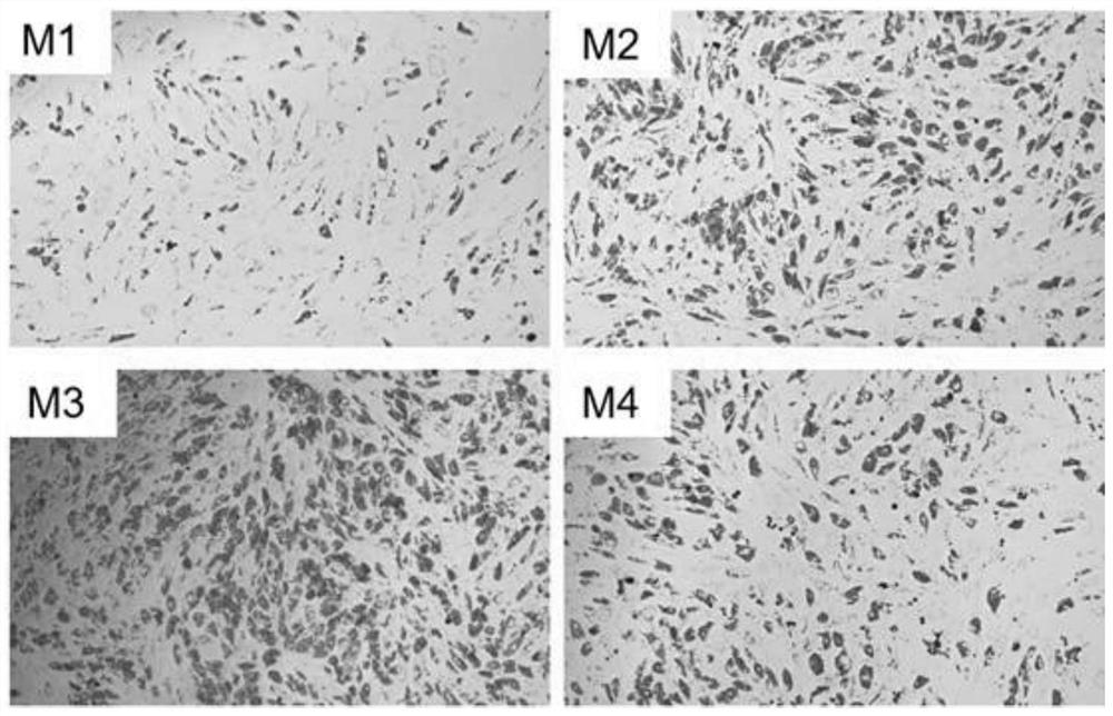A kind of mesenchymal stem cell adipogenic differentiation medium and its application