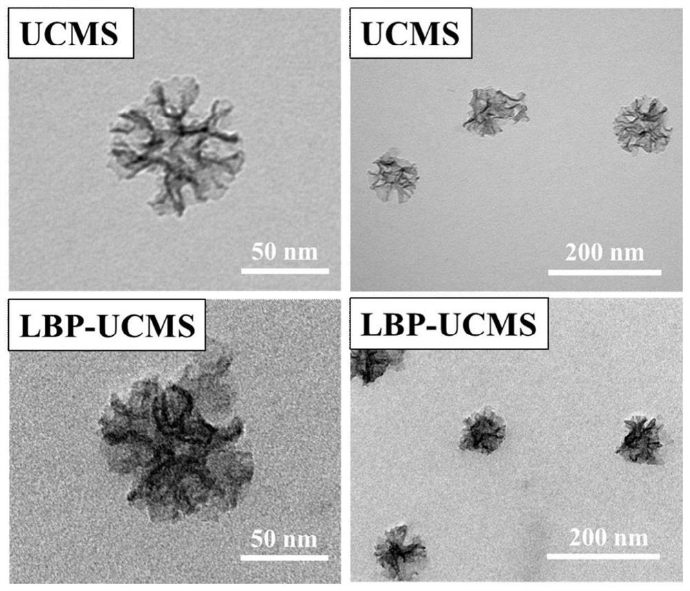 Preparation method and application of lycium barbarum polysaccharide oversized mesoporous silica nano adjuvant