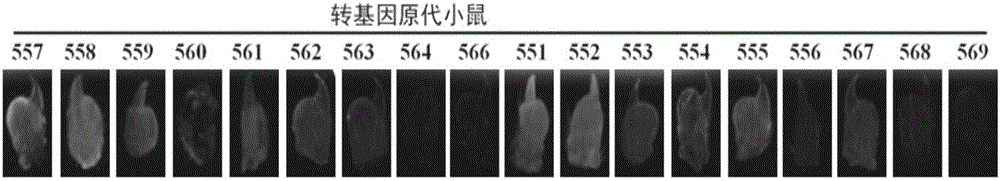 Mouse with human nerve growth factor transgenes as well as preparation method and application of mouse
