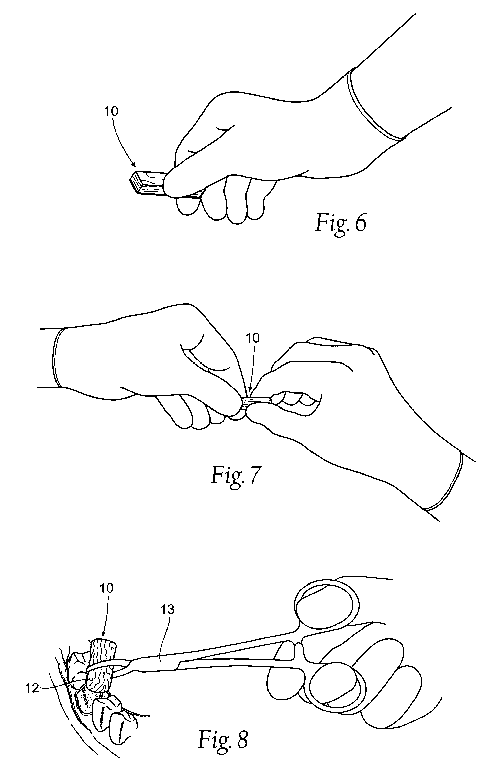 Compositions, assemblies, and methods applied during or after a dental procedure to ameliorate fluid loss and/or promote healing, using a hydrophilic polymer sponge structure such as chitosan