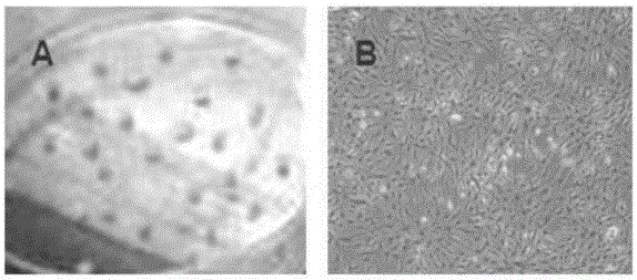 Method for inducing direct transdifferentiation of umbilical cord mesenchymal stem cells into erythroblasts