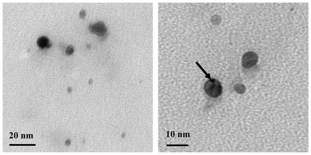 Preparation method of silver doped carbon dot based NO release-type wound dressing, and product and applications of product