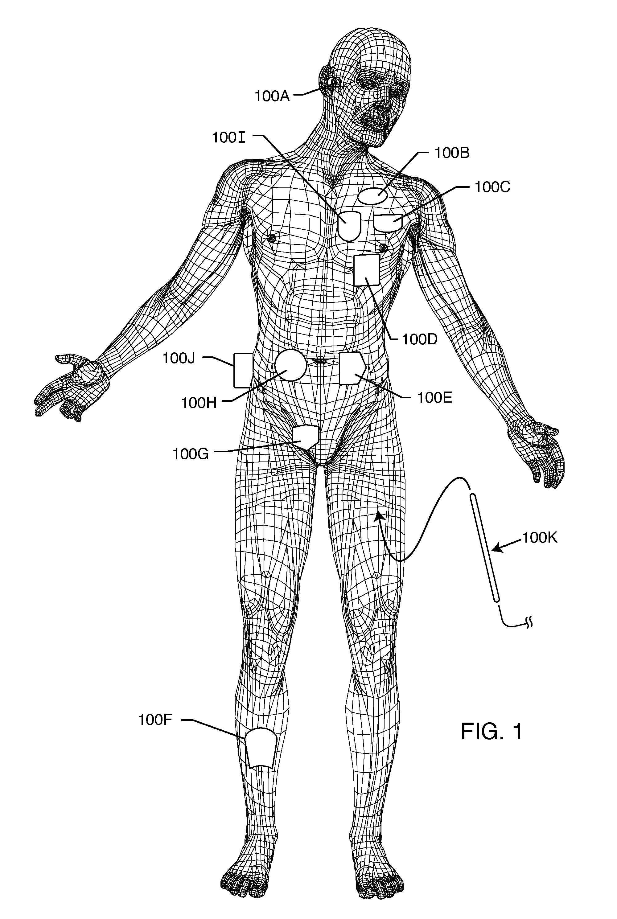 Self-resonant inductor wound portion of an implantable lead for enhanced MRI compatibility of active implantable medical devices