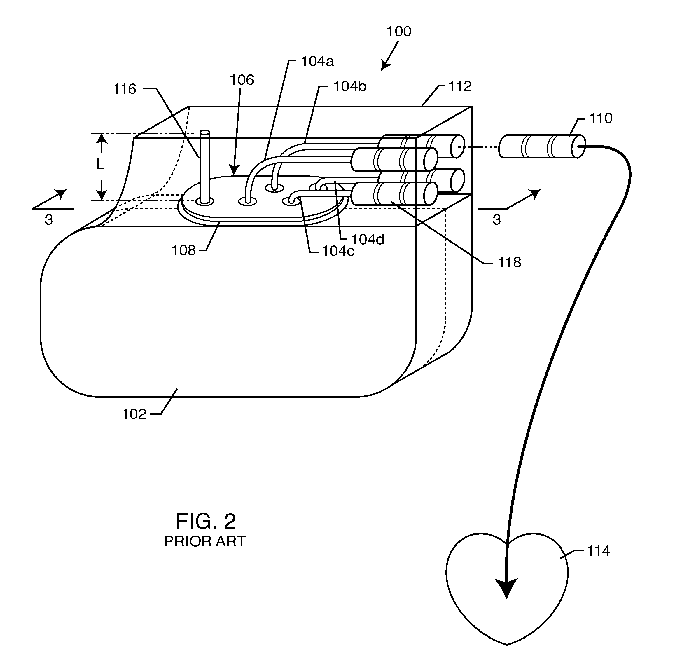 Self-resonant inductor wound portion of an implantable lead for enhanced MRI compatibility of active implantable medical devices