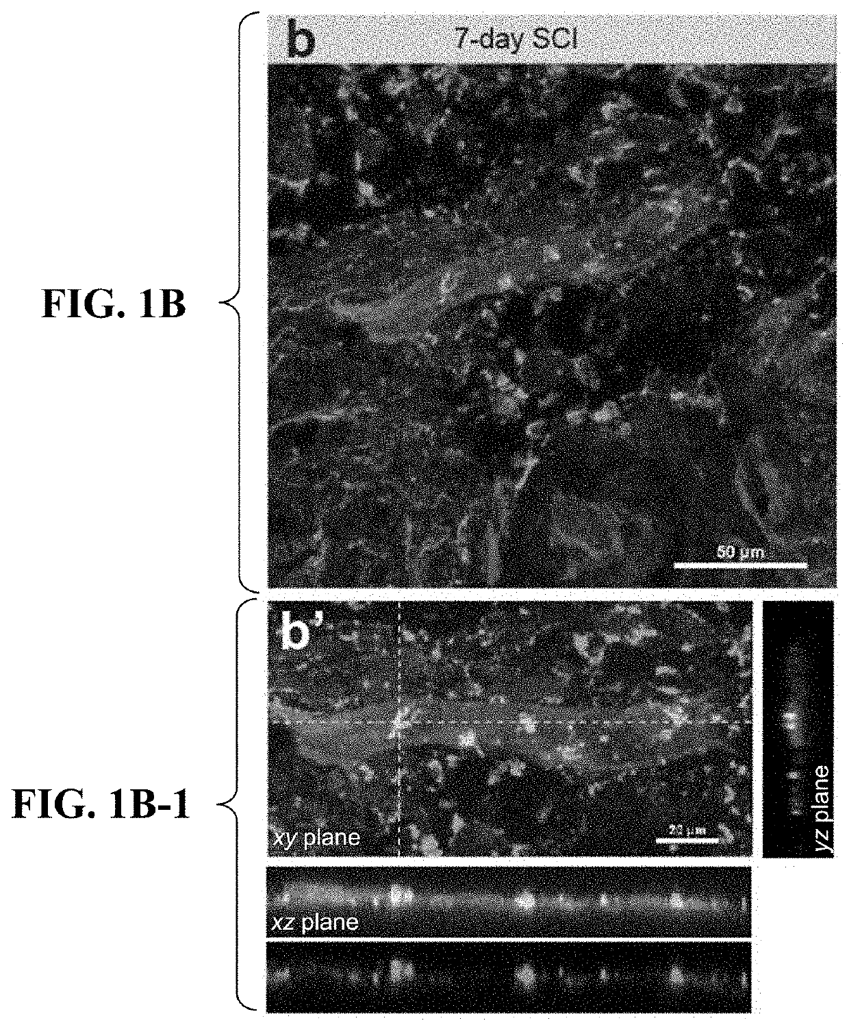 Inhibition of vascular endothelial cell-mediated phagocytic processes for treatment of demyelinating conditions