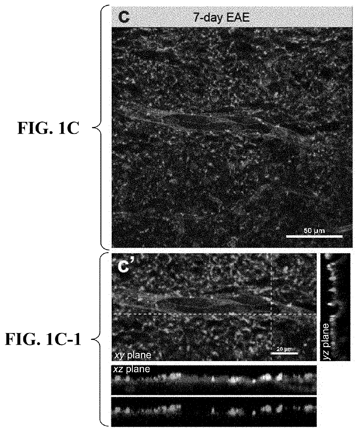 Inhibition of vascular endothelial cell-mediated phagocytic processes for treatment of demyelinating conditions